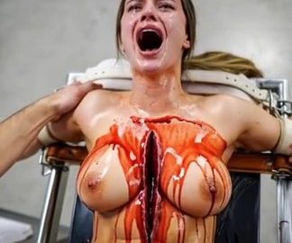 Surgical Execution on Table – AI Horror